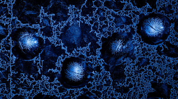 Csipkék és cseppek